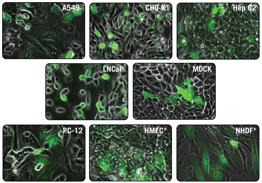 Visualization of High GFP Expression Using TransIT-X2® Dynamic Delivery System.