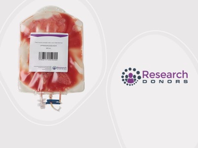 Enjoy same or next day delivery on fresh human leukopaks for your research needs